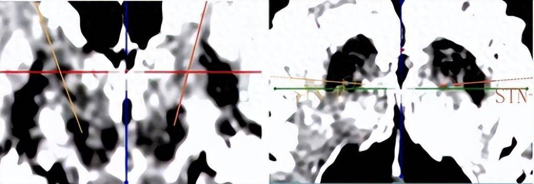 新澳精准资料免费提供510期丨东软集团：与通用技术集团共同支持未来东软医疗IPO